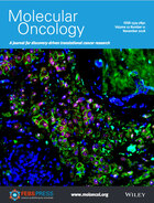 Tissue section from a HER2 positive breast carcinoma stained by ImmunoFISH reveals extensive intratumor heterogeneity. Image by I. H. Rye/H. Russnes. 