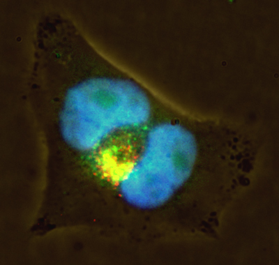Cell where the nucleus is shown with green fluorescence, the nucleus is stained blue, the lysosomes are stained red. As can be seen, the green is diffused across the nucleus and also lysosomes, thereby producing the compound color.