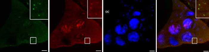 Figure legend: The caspase inhibitor dBruce (red) localizes to autophagosomes (green) in nurse cells during late oogenesis in Drosophila. Nuclei are stained in blue. (click to enlarge image)